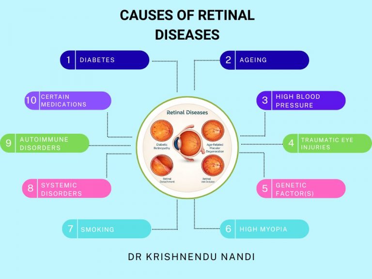 Causes of Retinal Diseases
