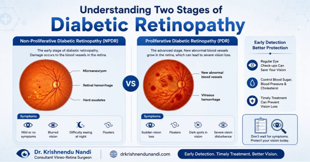 Types of Diabetic Retinopathy