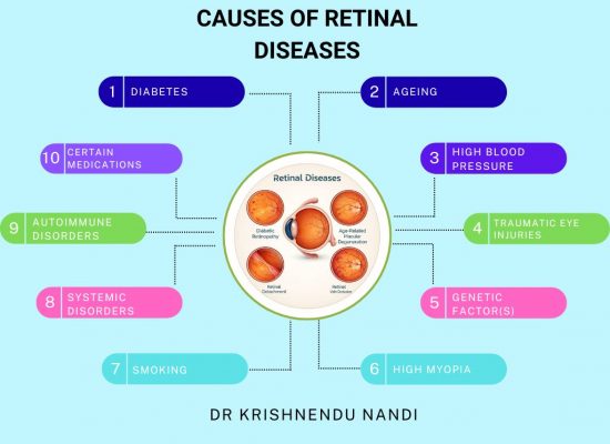 Causes of Retinal Diseases